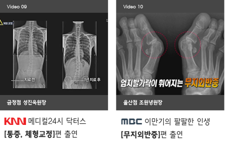 9. KNN 메디컬24시 닥터스 - 통증, 체형교정 / 10. MBC 이만기의 팔팔한 인생 - 무지외반증