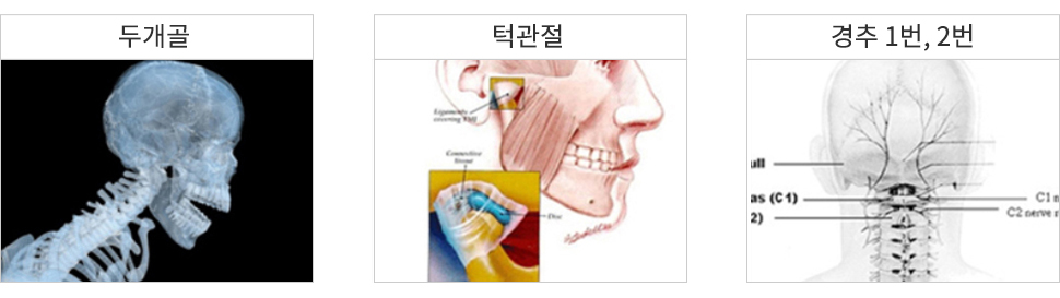 턱관절 치료원리 - 1.두개골 교정, 2.턱관절 교정, 3.제1ㆍ2경추 및 척추의 교정 